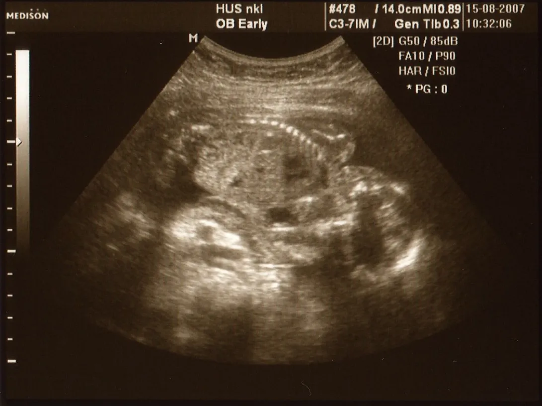 Junior